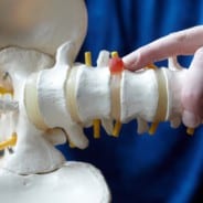 The Causes of a Spinal Cord Injury and the Steps to Take to Get Help