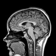 Utah Spinal Cord Injury Resources